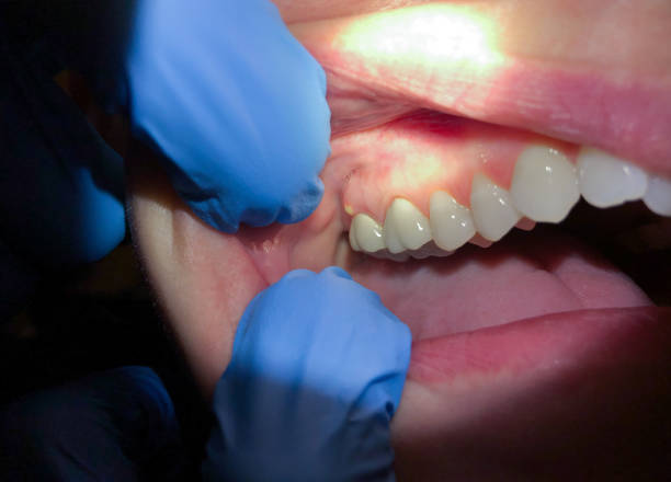 Best Emergency Broken Tooth Repair in Westover, WV