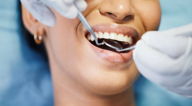 Best Emergency Root Canal Treatment in Westover, WV